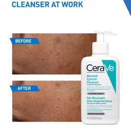 CeraVe Blemish Control Cleanser For Acne-Prone Skin - 236ml image 4