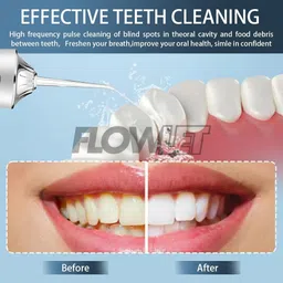 Flowlet Powerfull Smart Water Dental Flosser | Pure White with 4 Nozzle tips | 3 Jet Water Pressure Settings | Removers 99% Food Residues | 220ml Water Tank Capacity | IPX7 Waterproof | 6 Months Warranty image 3