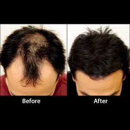 rebuilds Hair Building Fibers, Dark Brown, 27 grams image 3