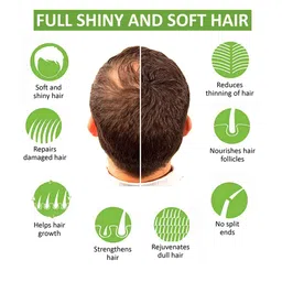 7daysnatural 7 DAYS Green Apple Shampoo For Dandruff - 100ml image 2