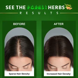 KISRA Set Of 3 Mahishmati Adivasi Forest Herbs Hair Growth Oil - 100 ml Each image 5