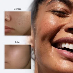 DROMEN & CO Pure Rose Water Face Mist 100 ml image 3