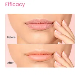 Earth Rhythm Fabulips Ph Lip Balm With SPF 30 For Dry & Chapped Lips Infused With Vitamin C & Alpha Arbutin For Dark Lips - 5Gm, Pink image 2