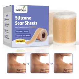 Wipness Silicone Scar Sheets 61 Inches (1.6 Meters) image 1