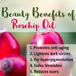 Park Daniel Set Of 2 100 % Pure & Natural Rosehip Oil & Moringa Oil- 100 ml Each image 2