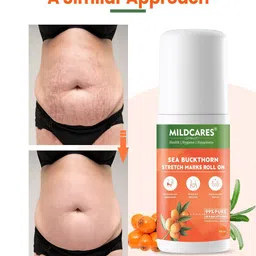 MILDCARES Stretch Marks Removal Roll-On Serum - 40 ml image 4