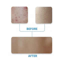 LUNAER Exfoliating Bodywash With Salicylic Acid & Vitamin E- 250 ml image 3