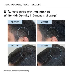 Bare Anatomy Advanced Anti-Grey Serum , Reduces Hair & Beard Greying, Non-Sticky, Odorless image 2