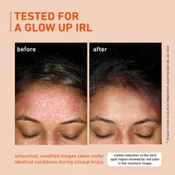 Plum 15% Vitamin C Serum for Glowing Skin | for Oily, Dry & Combination Skin | Reduce Pigmentation & Dark Spot |with Mandarin | Non-Irritating, Hydrating & Soothing | Face Serum for Men & Women | 20ml image 5