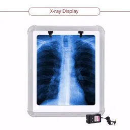 Sarvagya Surgical X-Ray View Box for 2 Film in White Acrylic Sheet, SSPL576 image 2