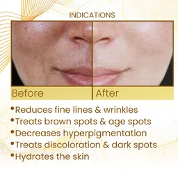 Adonis DS Gold Vitamin C Face Wash - 100 ml image 2