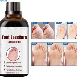 ayyiashi Corn Remover Gel Natural Skin Solution 30ml Safe Use-picture-36