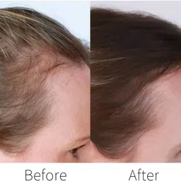 arcanuy Hair Thickening Fiber Black DF565 Strong Hair Volumizer Hair Fiber image 4