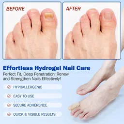 hukkyo Fungal Nail Patch Treatment for Effective Toenail Fungus and Infection Relief Nail Sanding Pad image 3