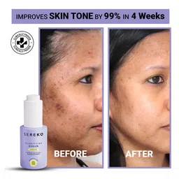 SEREKO Clarifying Face Serum with Vitamin C - 30 ml image 5