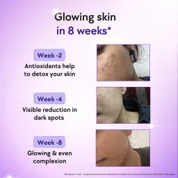 Chicnutrix Glow- 60 Effervescent Tablets| 500mg Japanese Glutathione & Vit. C| Antioxidants for clear, glowing skin| Sugar-free, Strawberry-lemon flavour image 5