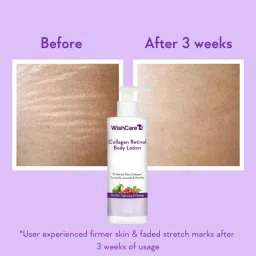 Wishcare Collagen 1% Retinol Body Lotion For Skin Tightening & Firming - With Niacinamide & Rosehip image 3