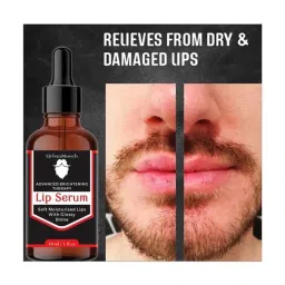 UrbanMooch Advance Brightning Lip Serum - 30 ml image 2