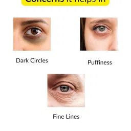 Eyecirque Under Eye Gel Serum With Niacinamide For Dark Circles - 30 g image 4