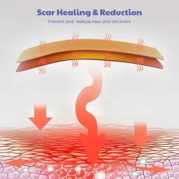 Wipness Silicone Scar Sheets 61 Inches (1.6 Meters) image 3