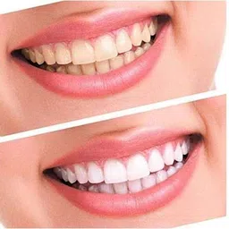 beauty que Professional Mint Flavor Advanced Teeth Whitening Strips for Sensitive Teeth image 3