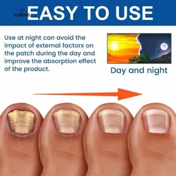 lorshel Fungal Nail Patches : fungal toenail treatment patch & nail fungus patch trea... Nail Sanding Pad image 2