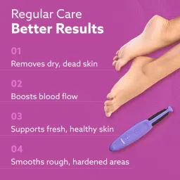 Agaro Callus Remover Cr1414 With 2 Heads Electric Pedicure Tool For Hard Skin Removal image 4