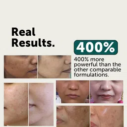 LAURITZ 2.5% Multi Molecular Hyaluronic Acid Intense Hydration Serum - 30 ml image 5