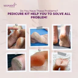 MEPOINT Pedicure Tools For Feet image 5