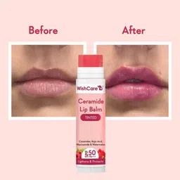 wishcare Tinted Ceramide Lip Balm with SPF50 PA+++ - Kojic Acid & Niacinamide Raspberry image 3