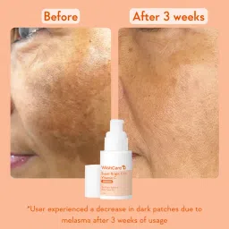 Wishcare Super Bright C16 Vitamin C Face Serum - Niacinamide, Kojic Acid & 4-n-BR For Pigmentation image 5