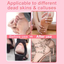 HayZBao Electric Foot File - Callus Remover for Feet,Professional Pedicure Tool for Dead Skin and Calluses,Adjustable Speed Foot File with 60 Pcs Sandpaper Discs - Pink image 5