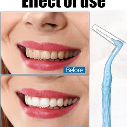 nhcdfa 25 Pcs Interdental Brush for Teeth, Interdental Brush, Interdental for Easy Cleaning Between Teeth 5 Sizes Soft Dental Brushes image 5