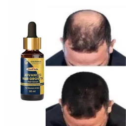 gauranga khadi kutir Khadi India Hair Growth Serum | with Redensyl, Anagain, Procapil & Capilia Longa For Hair Fall Control | For Men & Women | 30ml image 3