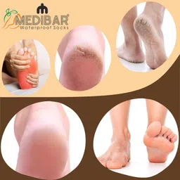 MEDIBAR Waterproof Rubber Socks, Anti Crack Gel Heel Ankle Length And Foot Protector Moisturizing Socks for Foot Care,Pain Relief for Men And Women,(Size-Large)(9-10-11)(Skin Brown) Pack of 1 image 5
