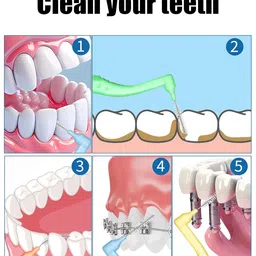 nhcdfa 25 Pcs Interdental Brush for Teeth, Interdental Brush, Interdental for Easy Cleaning Between Teeth 5 Sizes Soft Dental Brushes image 2