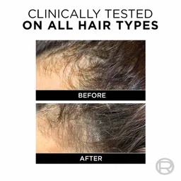 l'oreal paris L'Oréal Paris Anti-Hair Fall Conditioner, Reinforcing & Nourishing for Hair Growth, For Thinning & Hair Loss, With Arginine Essence and Salicylic Acid, Fall Resist 3X, 180/192.5 ML (Weight May Vary) image 3