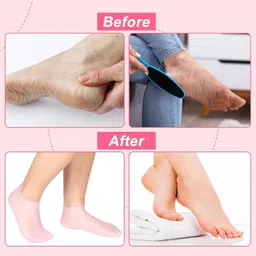 QUITESIDE Hydrating High-quality Silicone Socks for men and women that moisturize and repair cracked heels for dry, cracked feet Silicone Moisturizing Socks in a variety of colors. (PACK OF 2) image 5