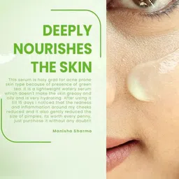 Lotus Herbals Set Of 2 Active Aloe + Niacinamide Brightening Boost Serum - 30ml Each image 3