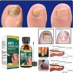 loviton Anti Paronychia Relief Oil For Prevents cracked, infected, or peeling skin Men & Women-picture-10