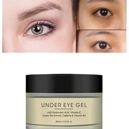 ontario Under Eye Cream Gel for Dark Circles, Puffy Eyes, Wrinkles & RemovalAX637-picture-24