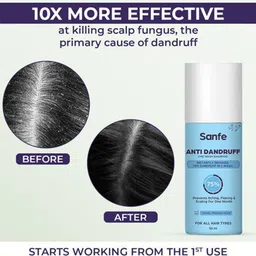 Sanfe Set Of 3 Anti Dandruff One Wash Shampoo Removes Dandruff - 50 ml Each image 5