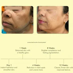 VEDICDERM Kumkumadi De-Pigmentation Night Cream- 50 g image 5