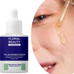 Face Skin Serum | 10% Niacinamide Serum + Zinc PCA 2% for Acne, Spots, Scars,-image-4