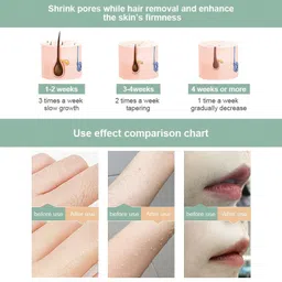 ClothyDeal IPL Ultra Permanent FullBody Laser HairRemoval Machine 999,999 Flashes_75F4V1XW2 Corded Epilator image 2