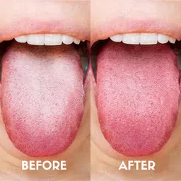 COCO Crush Ayurvedic Coconut with Cinnamon Oil for Oil Pulling, 50ml & Copper Tongue Cleaner, 1pc image 5