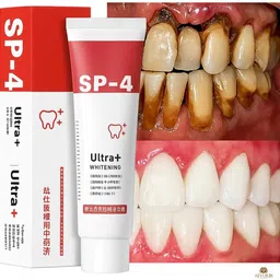 aeyurbs Sp 4 Teeth Cleaner | Enamel Safe Whitening Toothpaste Teeth Whitening Kit-picture-26