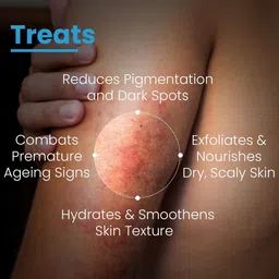 FIXDERMA COSMETIC LABORATORIES AHA Lotion 10 to Hydrate Skin & Soften Dryness - 100 ml image 5