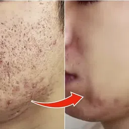 adjd Green Tea Sticks Face Shaping Mask Face Shaping Mask Face Shaping Mask image 2