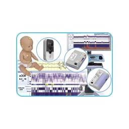 VNG Cerebral Function Monitor Encephalan-CFM image 2